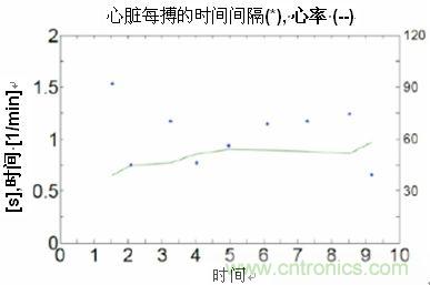 SCA121T加速感傳感測(cè)量浴室電子稱的心臟沖擊掃描圖波形